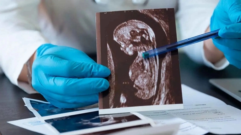 قضية تهز الأرجنتين.. طفلة حامل في العاشرة واعتقال مشتبه به